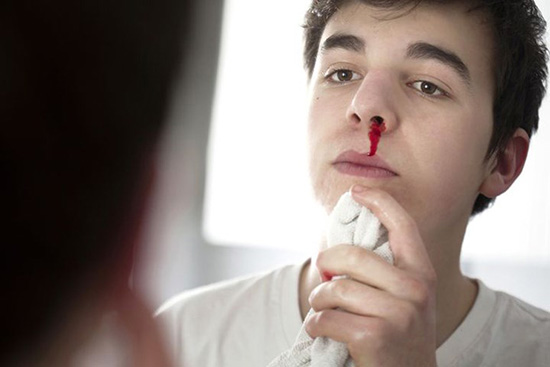Xử lý chảy máu mũi ở trẻ như thế nào là đúng?